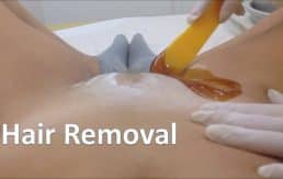 hair removal